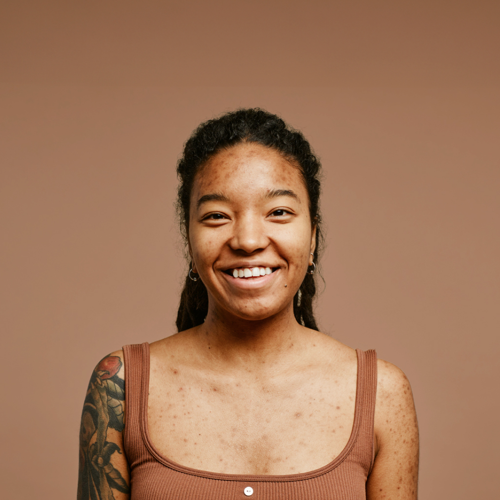 women with visible acne smiling against brown background