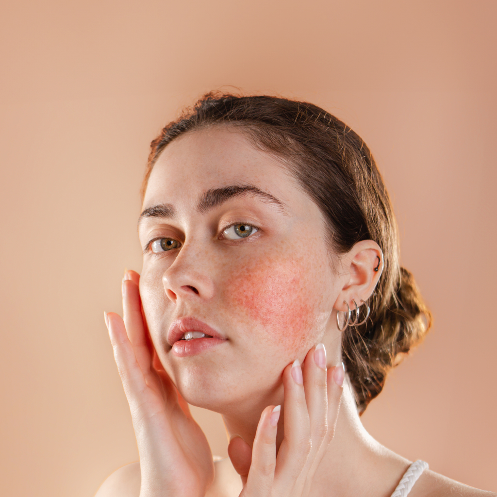 closeup of a women with rosey cheeks on a blush background